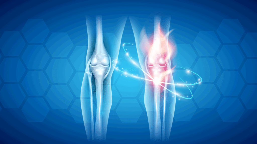 Problemi-ginocchio-psicosomatica