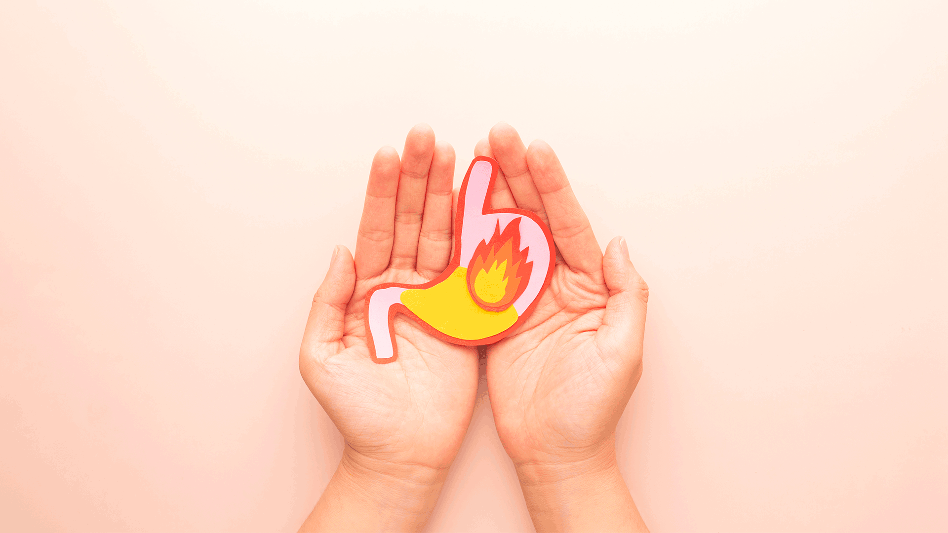 Reflusso, un fuoco di ritorno