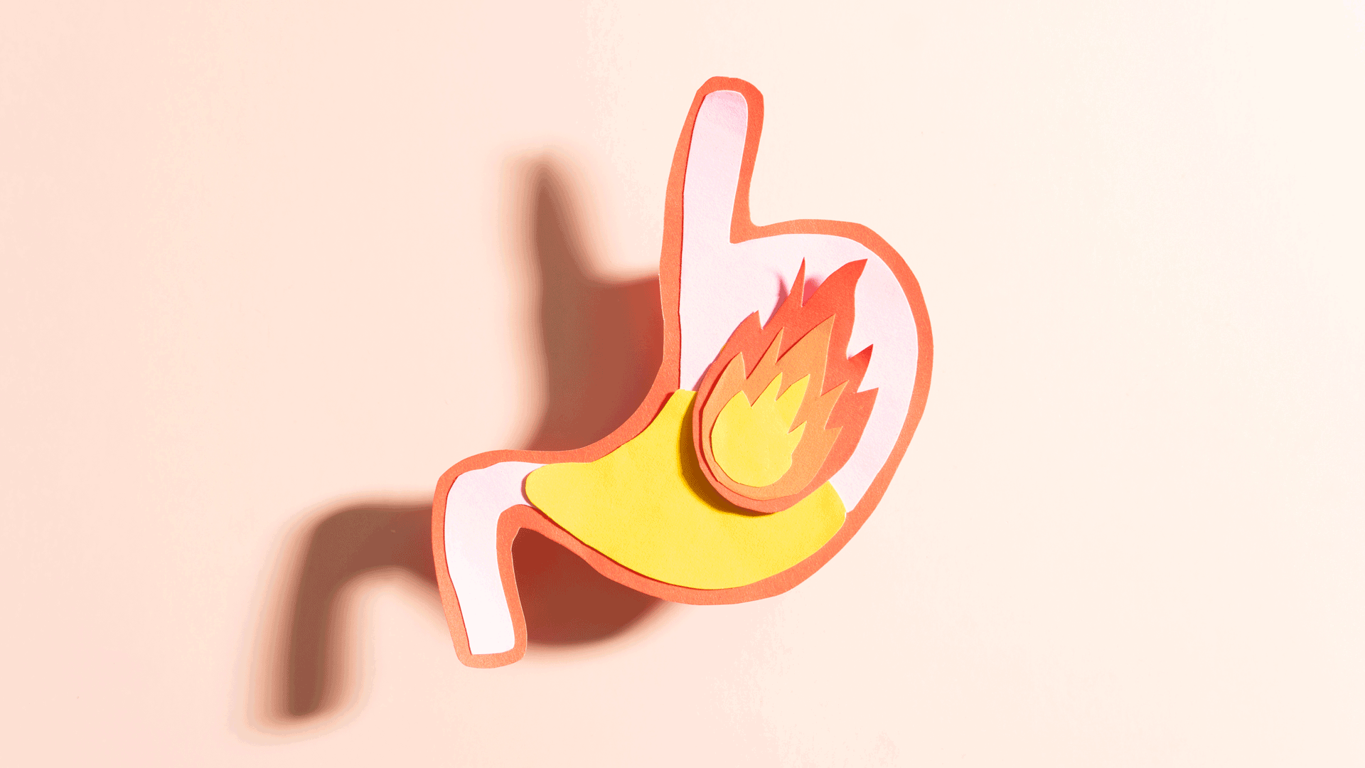 La gastrite psicosomatica: perchè arriva, come si cura