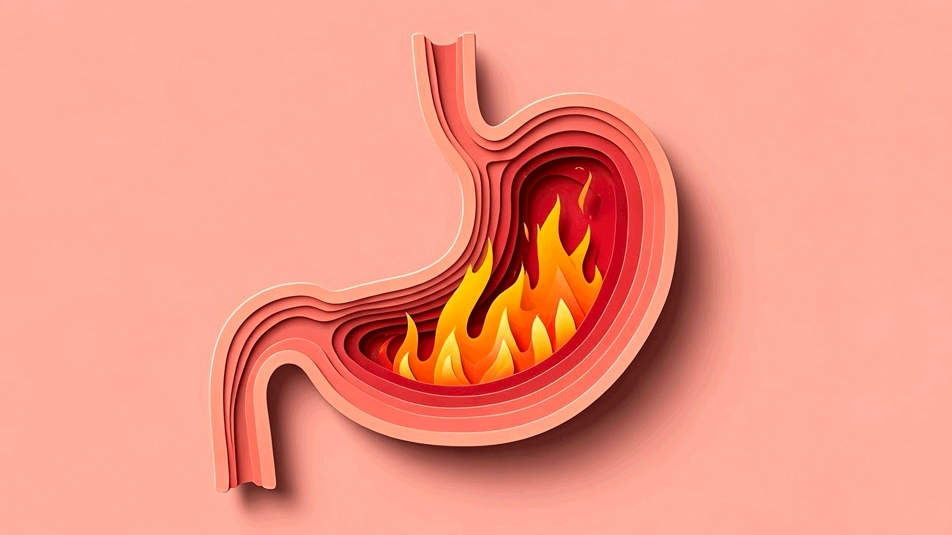 Gastrite: guida pratica a sintomi, cause e cure naturali
