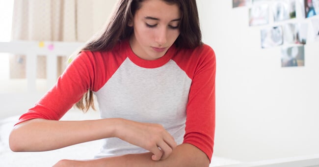 Orticaria dei bambini: cause e cure