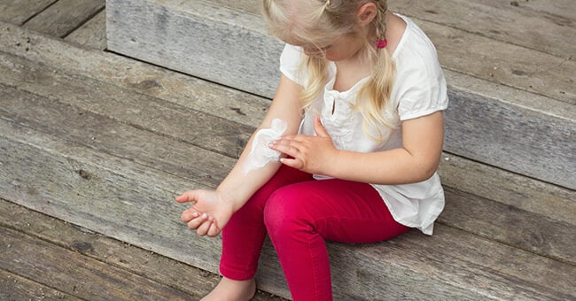 La varicella passa senza farmaci